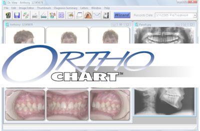 orthochart software